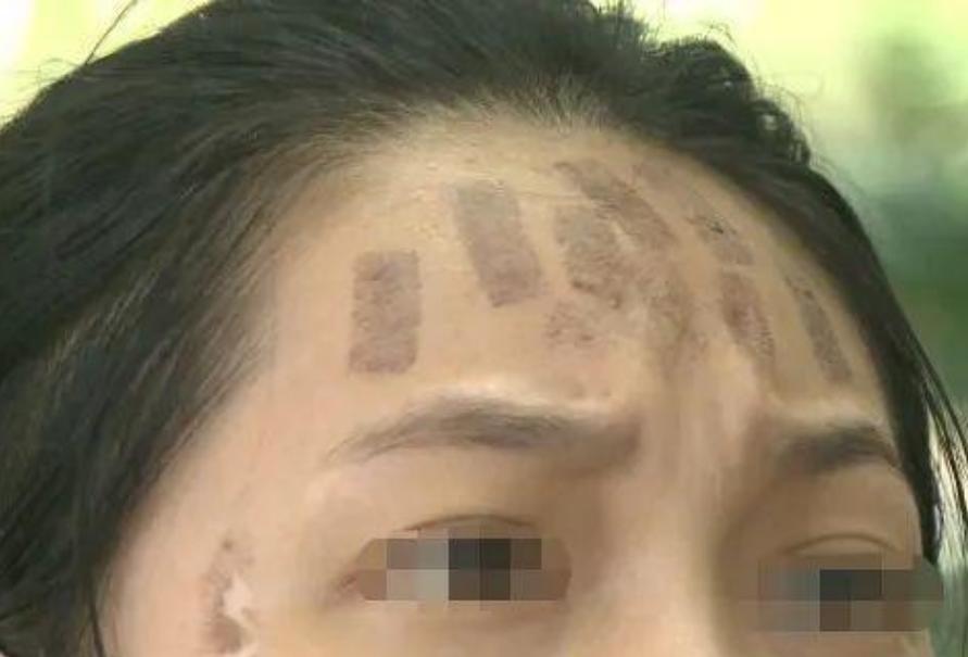 成都光子嫩肤价格，科技重塑肌肤之美